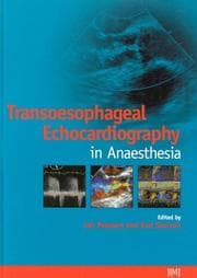 Tapa de Transoesophageal echocardiography in anaesthesia