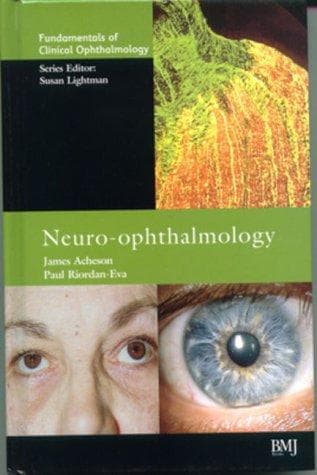 Tapa de Neuro-ophthalmology