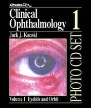 Tapa de Clinical Ophthalmology Photo Cd #1