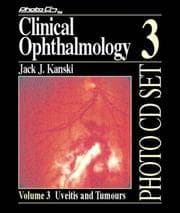 Tapa de Clinical Ophthalmology Photo Cd Unit #3