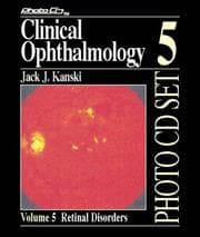 Tapa de Clinical Ophthalmology Photo Cd Unit 5