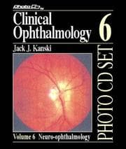 Tapa de Neuro-Ophthalmology (Clinical Ophthalmology Photo CD Set , Vol 6)