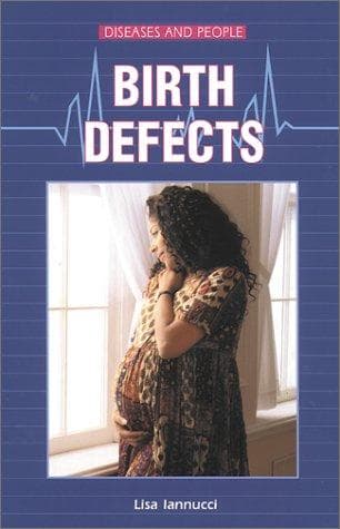 Tapa de Birth Defects (Diseases and People)