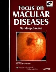 Tapa de Focus on Macular Diseases