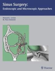Tapa de Sinus Surgery