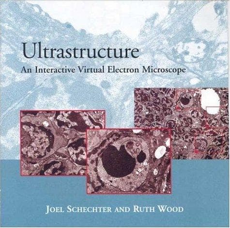 Tapa de Ultrastructure