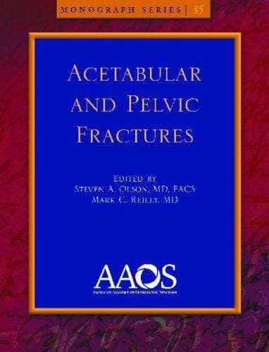 Tapa de Acetabular and pelvic fractures
