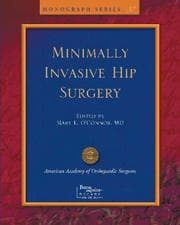 Tapa de Limited Incisions for Total Hip Arthroplasty (Monograph Series (American Academy of Orthopaedic Surgeons))