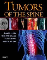 Tapa de Tumors of the spine