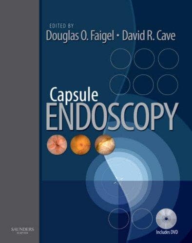 Tapa de Capsule endoscopy
