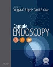 Tapa de Capsule endoscopy
