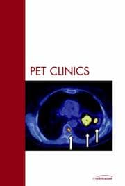 Tapa de Lymphoma, An Issue of PET Clinics (The Clinics: Radiology)