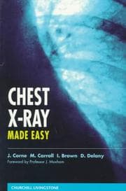 Tapa de Chest X-ray made easy