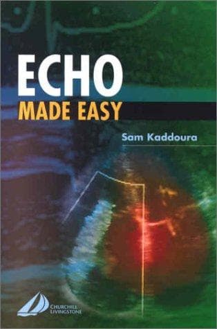 Tapa de Echo Made Easy