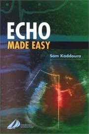 Tapa de Echo Made Easy