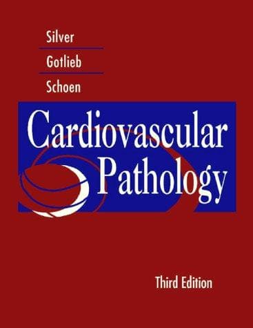 Tapa de Cardiovascular pathology