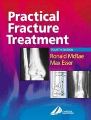 Tapa de Practical Fracture Treatment