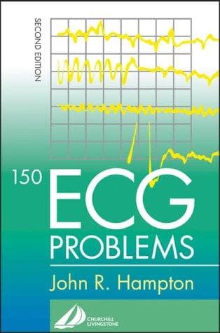 Tapa de 150 ECG Problems
