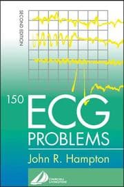 Tapa de 150 ECG Problems