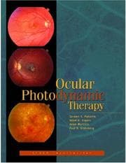 Tapa de Ocular photodynamic therapy