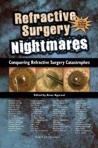 Tapa de Refractive Surgery Nightmares