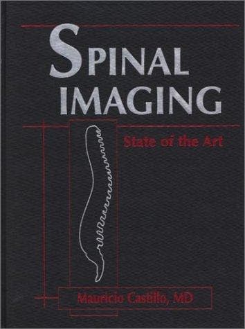 Tapa de Spinal Imaging