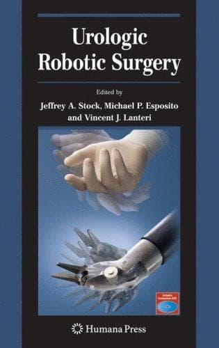 Tapa de Urologic robotic surgery