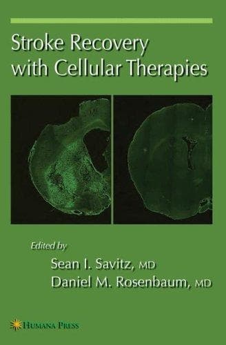 Tapa de Stroke recovery with cellular therapies