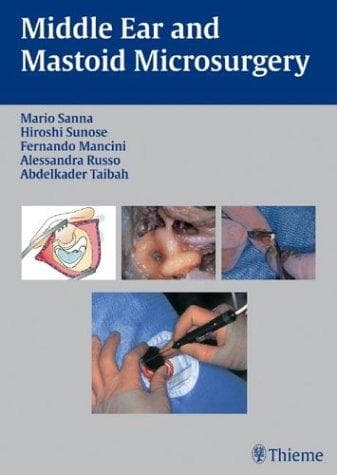 Tapa de Middle Ear and Mastoid Microsurgery