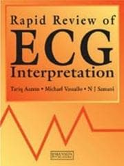Tapa de Rapid Review of ECG Interpretation