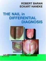 Tapa de The nail in differential diagnosis