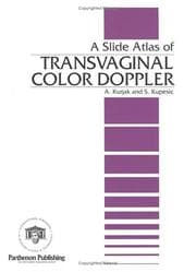 Tapa de A Slide Atlas of Transvaginal Color Doppler