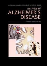 Tapa de An Atlas of Alzheimer's Disease