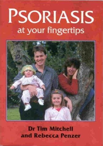 Tapa de Psoriasis at your fingertips
