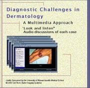 Tapa de Diagnostic Challenges in Dermatology