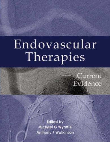 Tapa de Endovascular Therapies