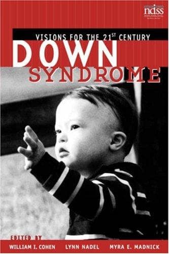 Tapa de Down syndrome
