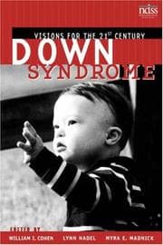 Tapa de Down syndrome