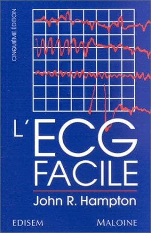 Tapa de L' ECG facile