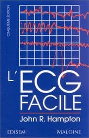 Tapa de L' ECG facile