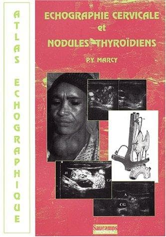Tapa de Echographie cervicale et nodules thyrodiens