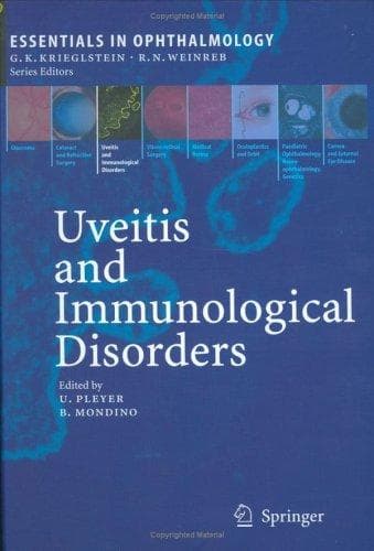 Tapa de Uveitis and immunological disorders