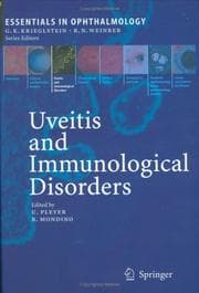 Tapa de Uveitis and immunological disorders