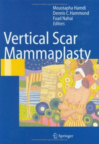 Tapa de Vertical scar mammaplasty