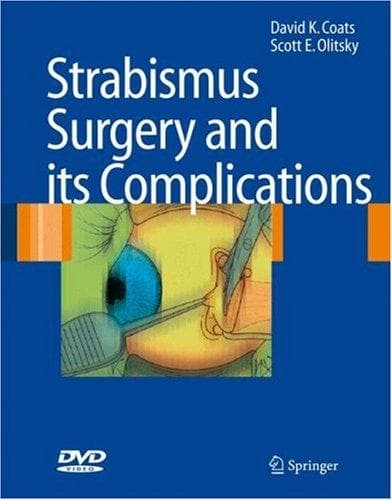 Tapa de Strabismus surgery and its complications