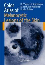 Tapa de Color atlas of melanocytic lesions of the skin