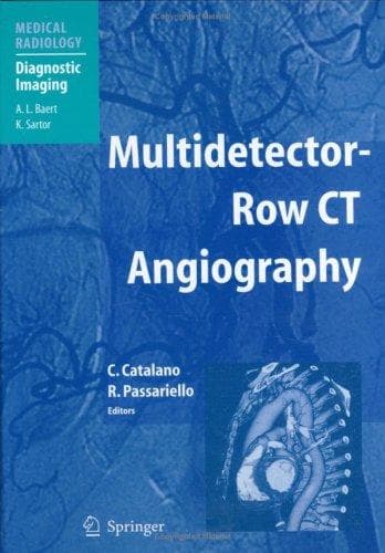 Tapa de Multidetector-row CT angiography