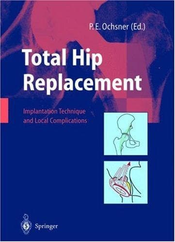 Tapa de Total hip replacement