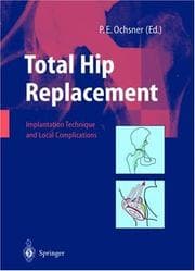 Tapa de Total hip replacement