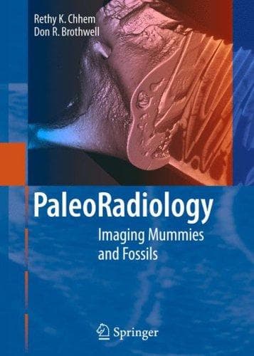 Tapa de Paleoradiology
